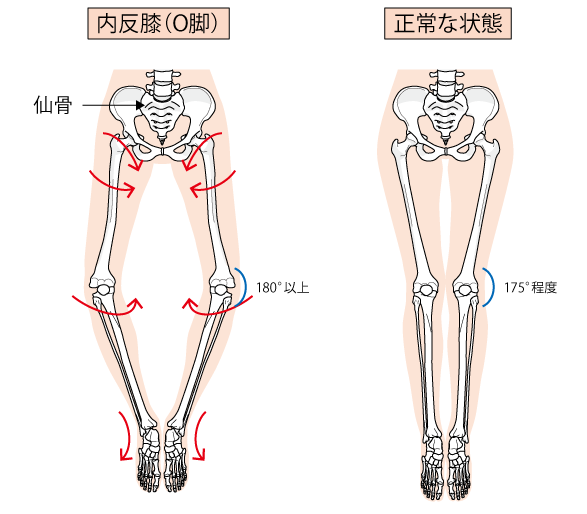 猫背改善でメリハリボディへ 高松市 モミグリデイスパ Momiguri Day Spa